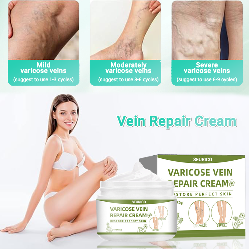 Seurico™ horse chestnut Organic Veins Treatment Cream