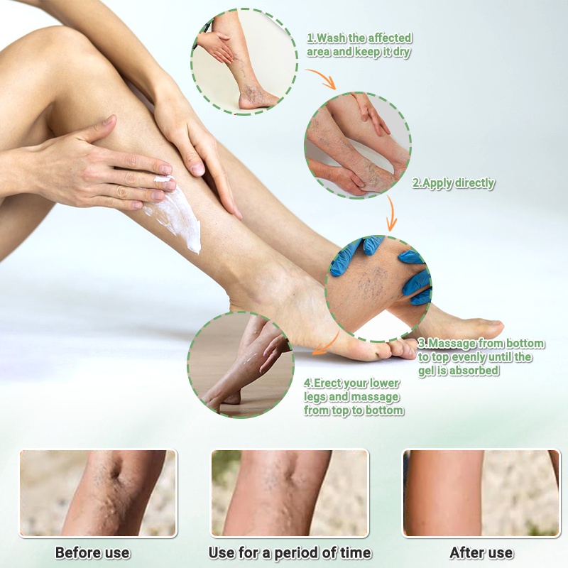 Seurico™ horse chestnut Organic Veins Treatment Cream