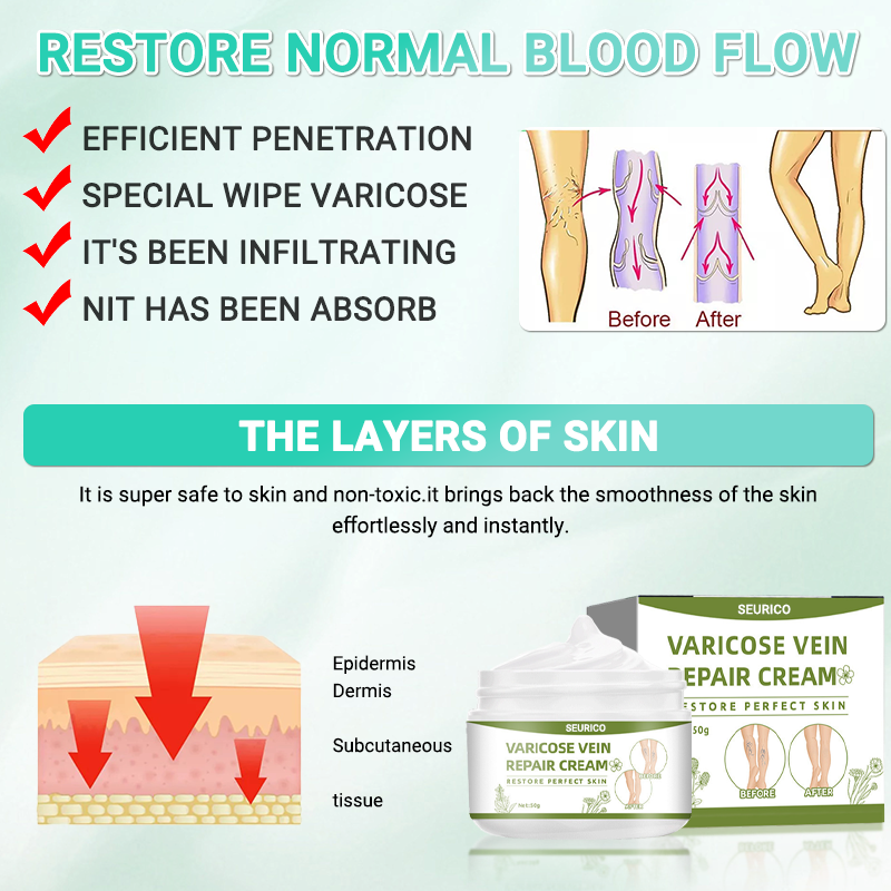 Seurico™ horse chestnut Organic Veins Treatment Cream