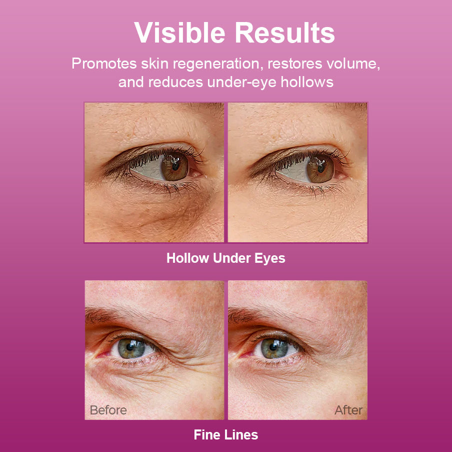 🏆Limited-Time Offer🏆 — [Dr.Melaxen Official] Calcium Multi-Effect Moisturizing Cream | Anti-aging, Firming, Wrinkle Reduction🔥