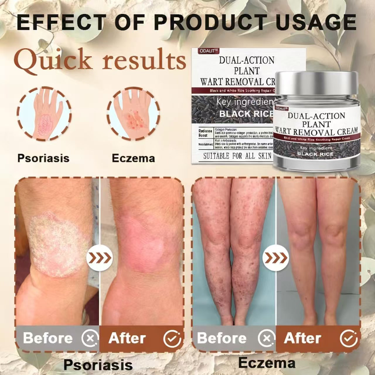 ODALIT™ Black Rice Skin Repair Essence Cream ⚕️ FDA Certified (Removes warts and skin growths, improves keratin buildup and seborrheic dermatitis, follicular keratosis, age spots, and bruising)