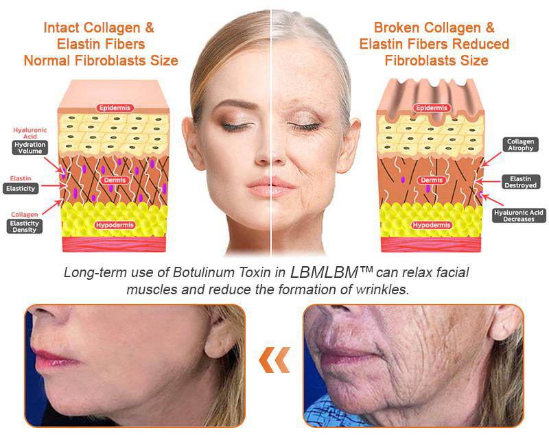 🍯 FDA Approved: LBMLBM™ Bee Venom Pro Repair Cream — 🔥80% OFF for a Limited Time!🔥