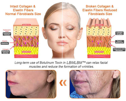 🍯 FDA Approved: LBMLBM™ Bee Venom Pro Repair Cream — 🔥80% OFF for a Limited Time!🔥