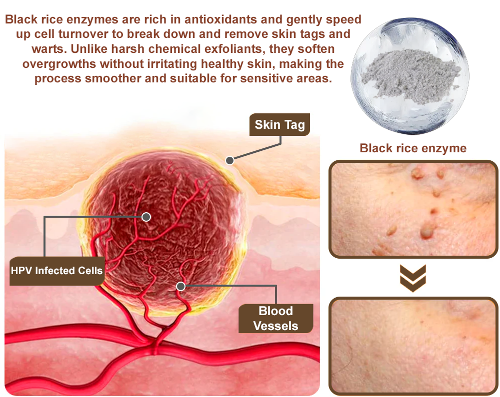 ODALIT™ Black Rice Skin Repair Essence Cream ⚕️ FDA Certified (Removes warts and skin growths, improves keratin buildup and seborrheic dermatitis, follicular keratosis, age spots, and bruising)