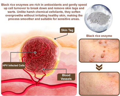 ODALIT™ Black Rice Skin Repair Essence Cream ⚕️ FDA Certified (Removes warts and skin growths, improves keratin buildup and seborrheic dermatitis, follicular keratosis, age spots, and bruising)
