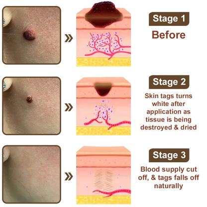 ODALIT™ Black Rice Skin Repair Essence Cream ⚕️ FDA Certified (Removes warts and skin growths, improves keratin buildup and seborrheic dermatitis, follicular keratosis, age spots, and bruising)