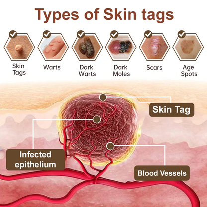 ODALIT™ Black Rice Skin Repair Essence Cream ⚕️ FDA Certified (Removes warts and skin growths, improves keratin buildup and seborrheic dermatitis, follicular keratosis, age spots, and bruising)