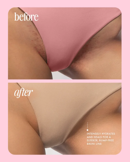 Goodbye Razor Bumps ✨ – Get Smooth, Glowing Skin in Just 5 Seconds with LBMLBM™ 🌟