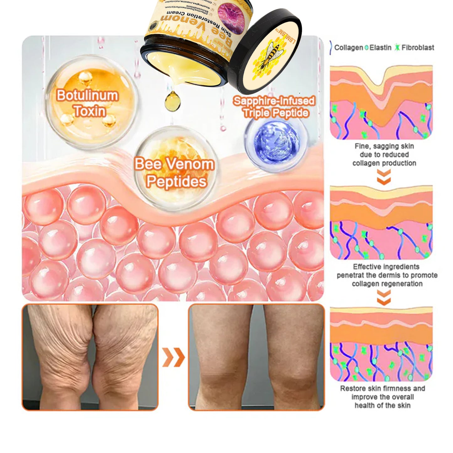 🍯 FDA Approved: LBMLBM™ Bee Venom Pro Repair Cream — 🔥80% OFF for a Limited Time!🔥