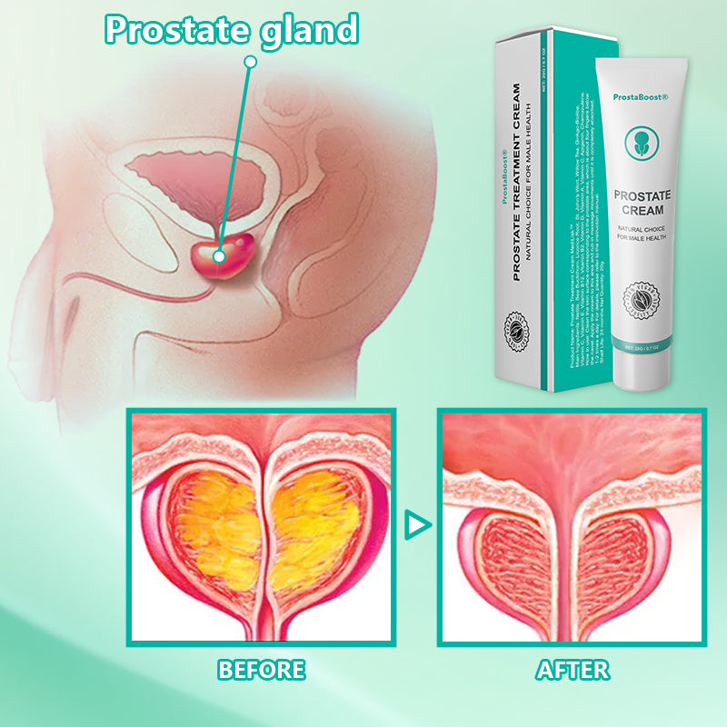 🚀【Powerful Erection Booster】ProstaBoost®: Premium Topical Cream for Men