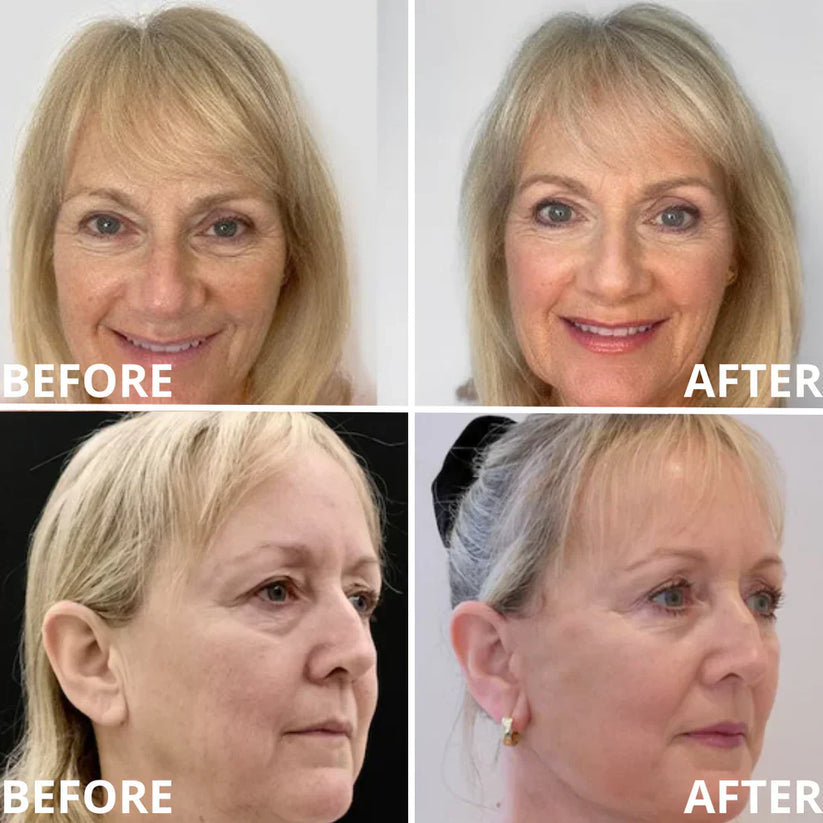 🏆Christmas Limited Time Offer🏆—JEREMYTIS™ Calcium Multi-Effect Eye Cream💫 Anti-Aging Firming Eye Treatment Bar🔥