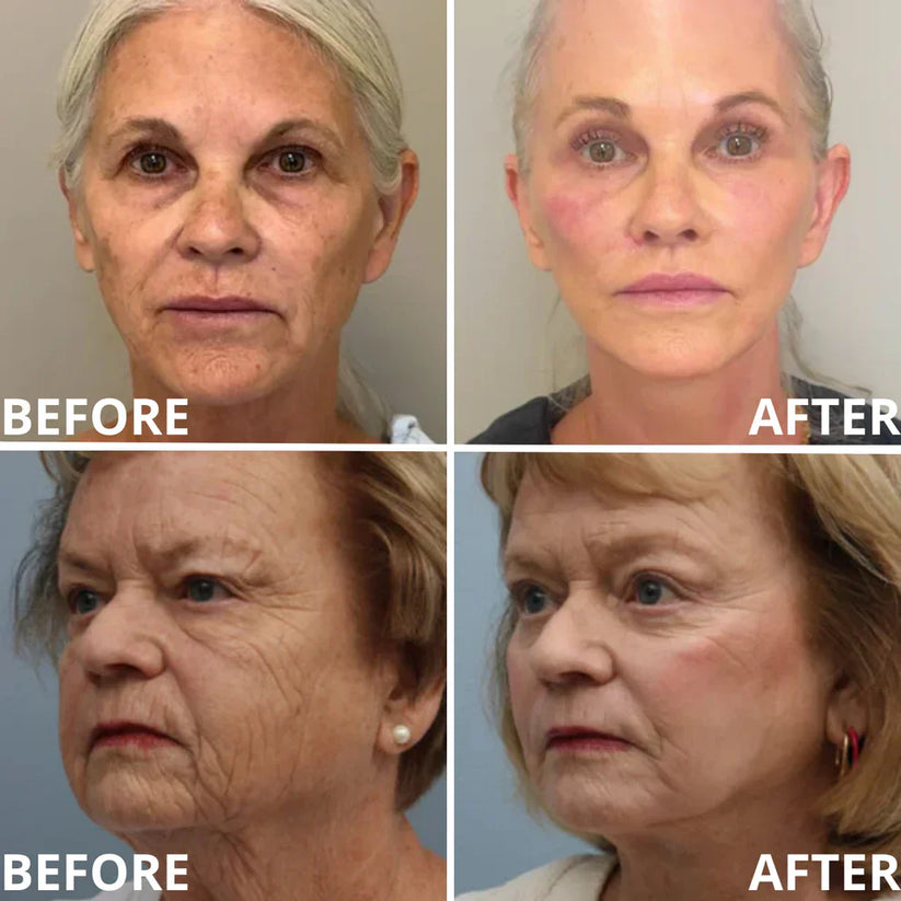 🏆Christmas Limited Time Offer🏆—JEREMYTIS™ Calcium Multi-Effect Eye Cream💫 Anti-Aging Firming Eye Treatment Bar🔥