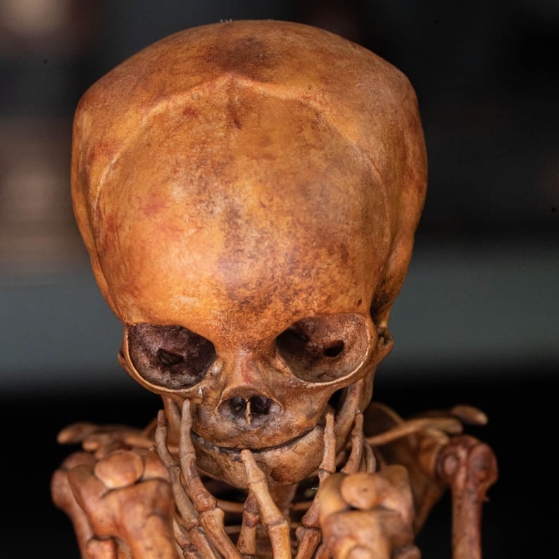 3D Printed Human Fetus, Infant baby skeleton, hand painted figurine, creepy horror decor, curio cabinet gift